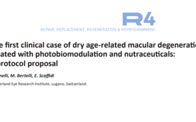 The first clinical case of dry age-related macular degeneration treated with photobiomodulation and nutraceuticals: a protocol proposal