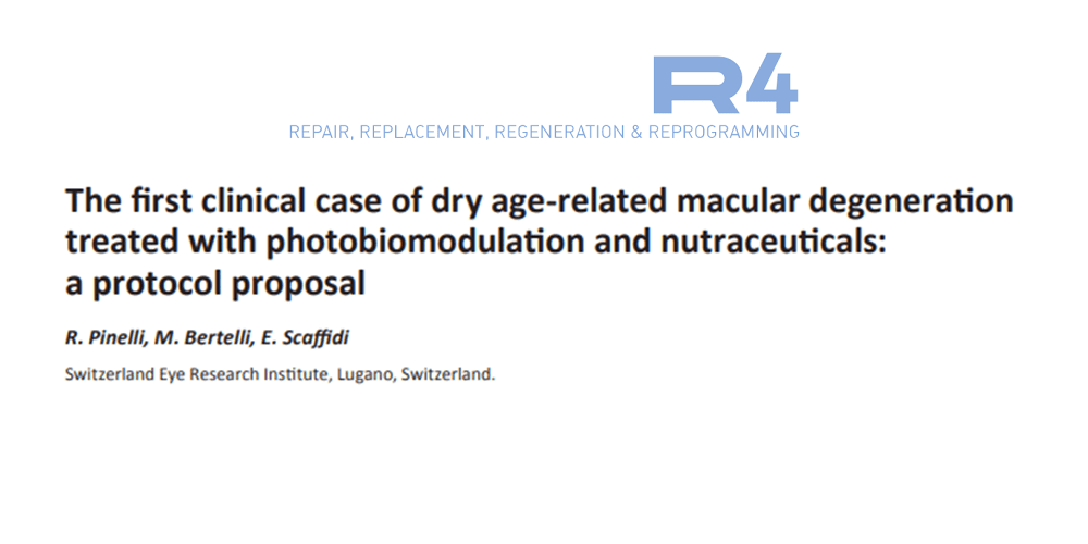 The first clinical case of dry age-related macular degeneration treated with photobiomodulation and nutraceuticals: a protocol proposal