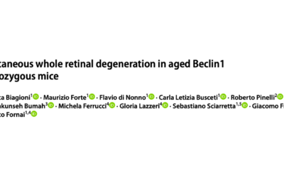 Spontaneous whole retinal degeneration in aged Beclin1 heterozygous mice